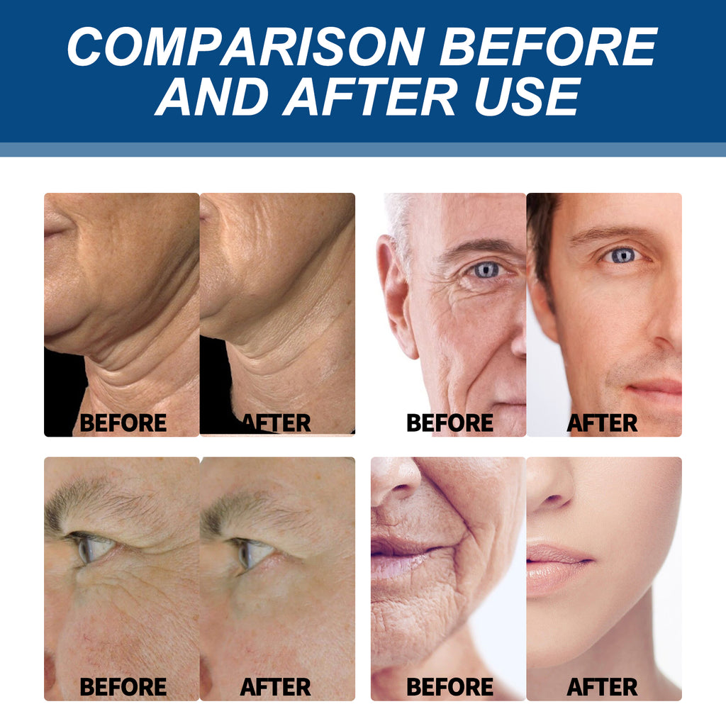 Men’s Collagen Wrinkle Remover Cream